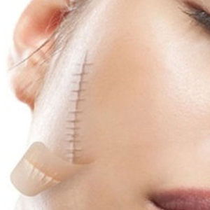 Top 5 spa và thẩm mỹ viện trị sẹo tại TP.HCM uy tín, chất lượng, hiệu quả